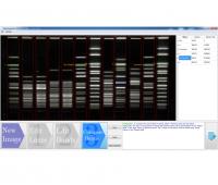 Electrophoresis Image Analysis Software