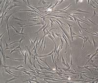 Human Adipose Tissue Derived Mesenchymal Stem Cells